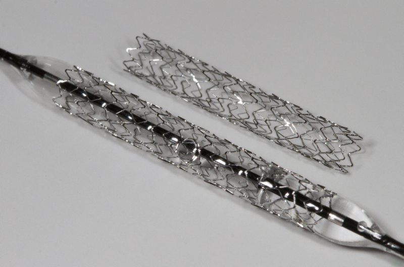 stent1.jpg