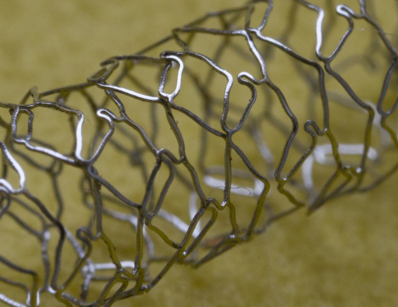 stent3.jpg