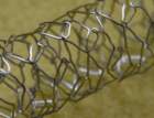 stent3_small.jpg