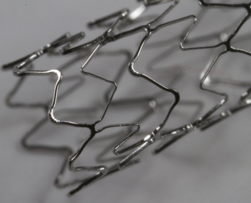 stent4.jpg
